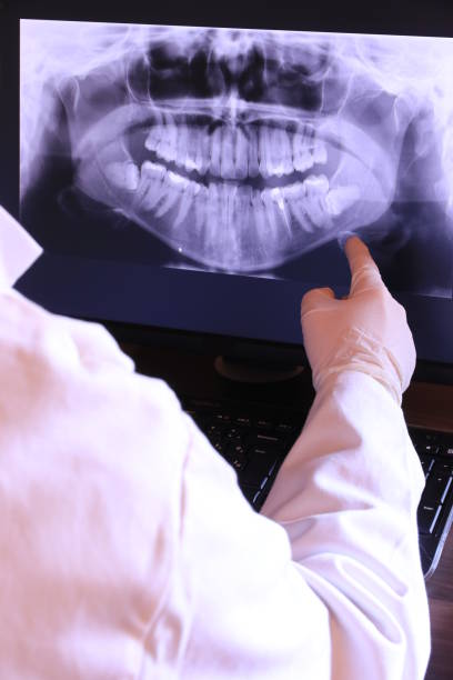 Best Urgent Care for Lost Fillings or Crowns in Holt, MI