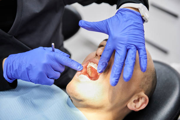 Best Emergency Wisdom Teeth Removal in Holt, MI
